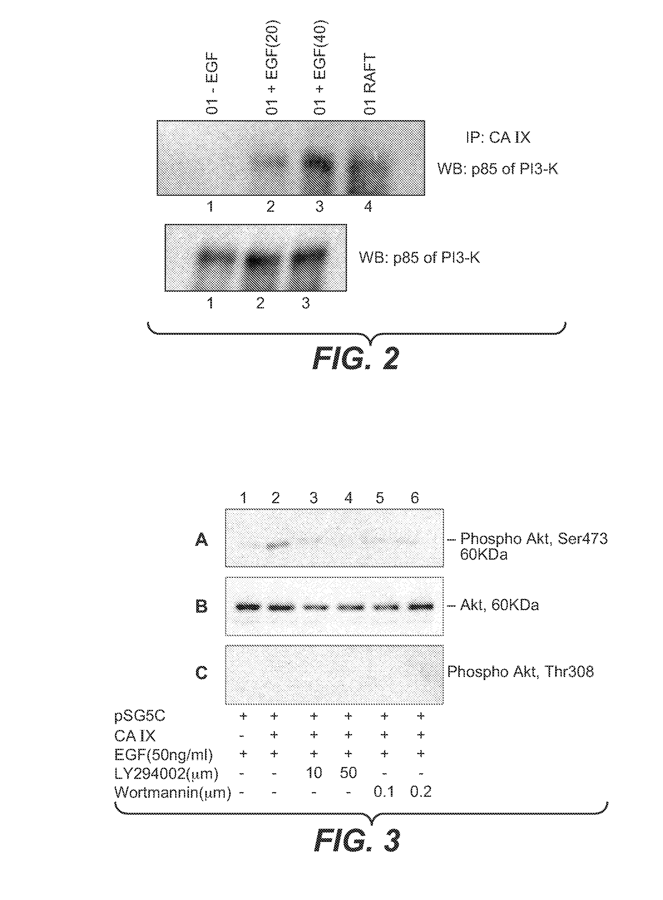 MN/CA IX and EGFR Pathway Inhibition