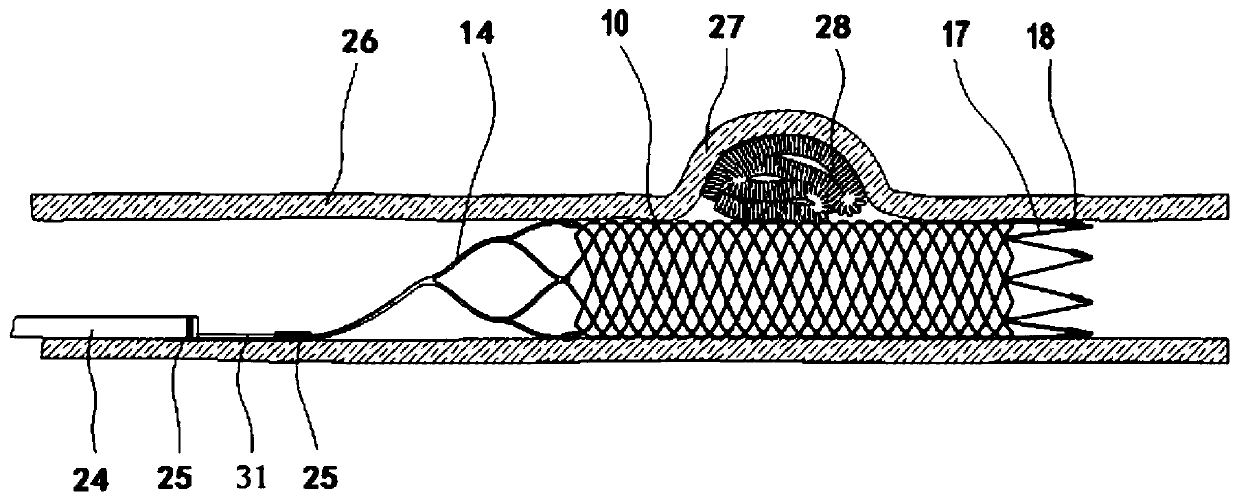 Knitting support capable of being completely recycled