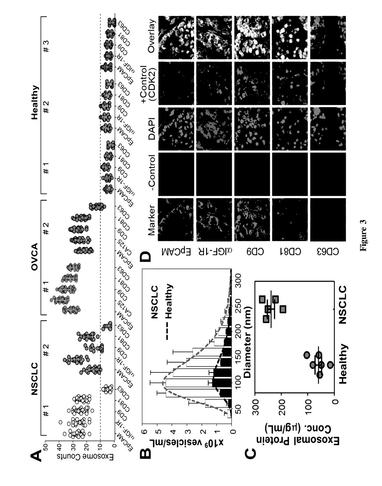 Non-invasive monitoring cancer using integrated microfluidic profiling of circulating microvesicles