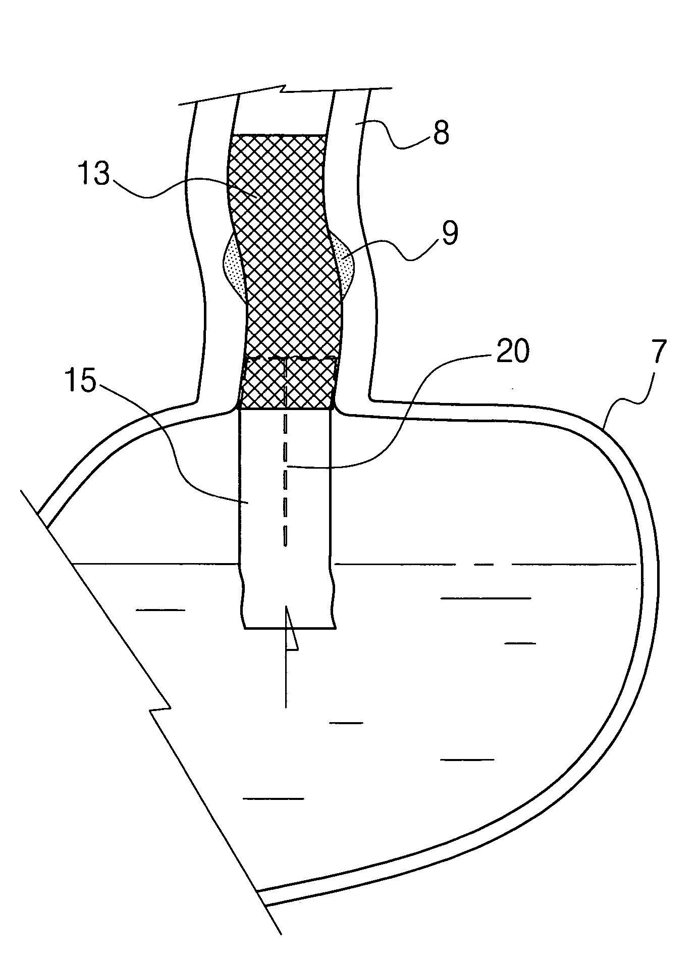 Esophageal stent