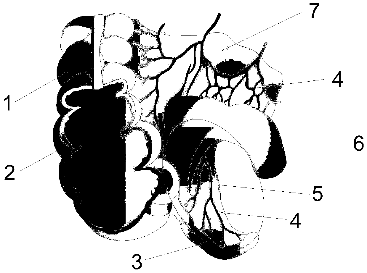 Appendectomy model