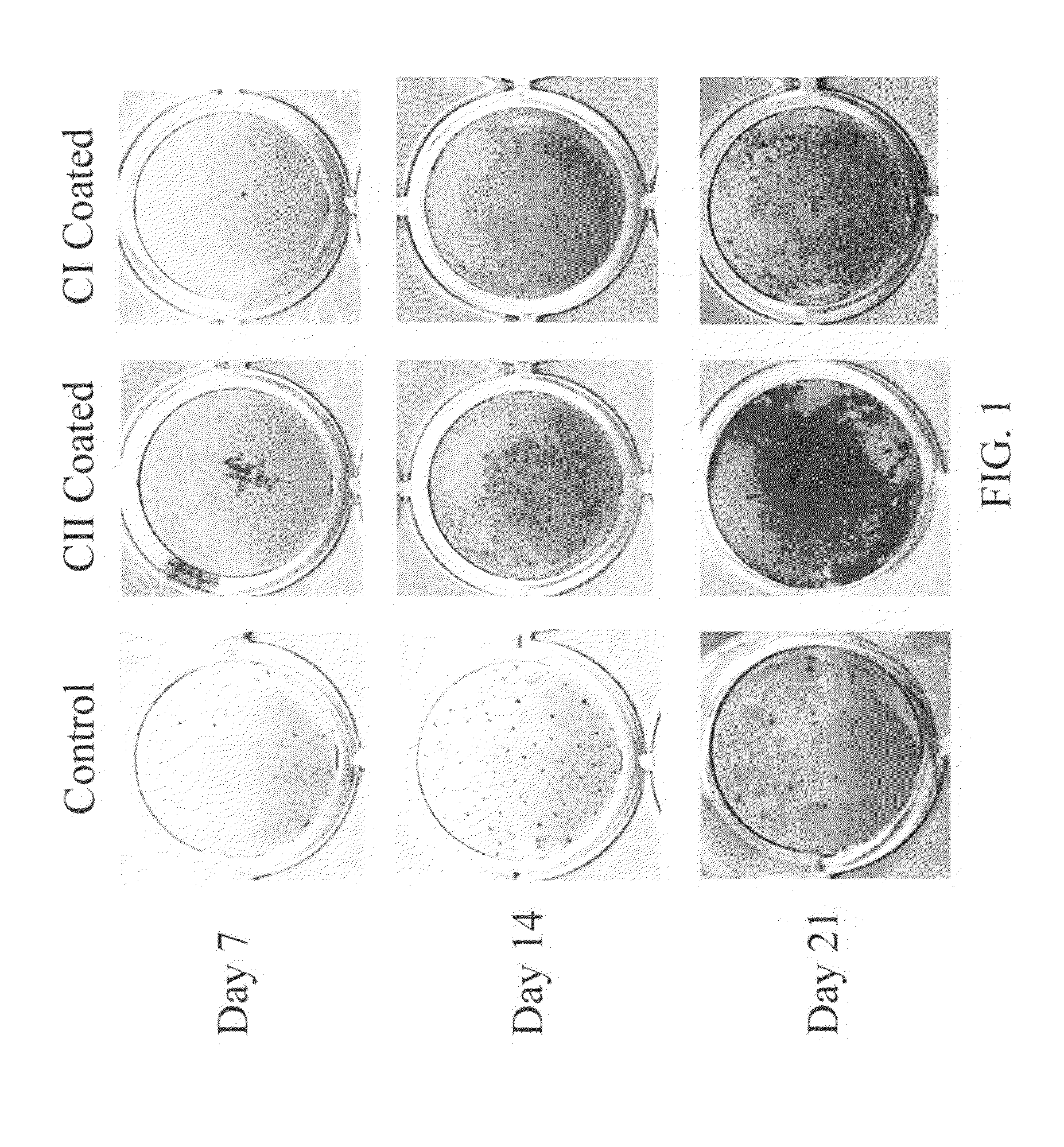 Bone implant and manufacturing method thereof