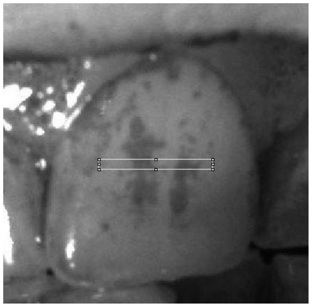 Method for plaque detection