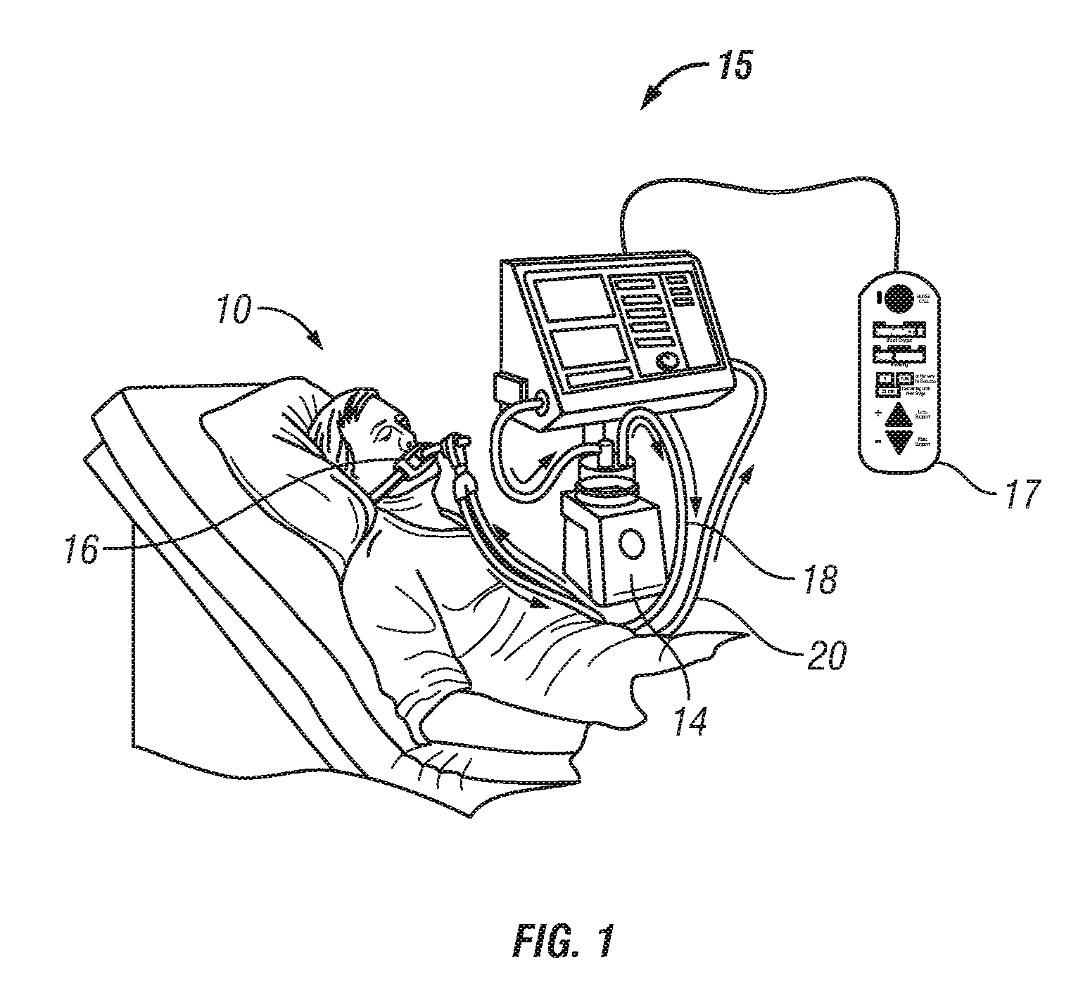 Patient-controlled ventilation