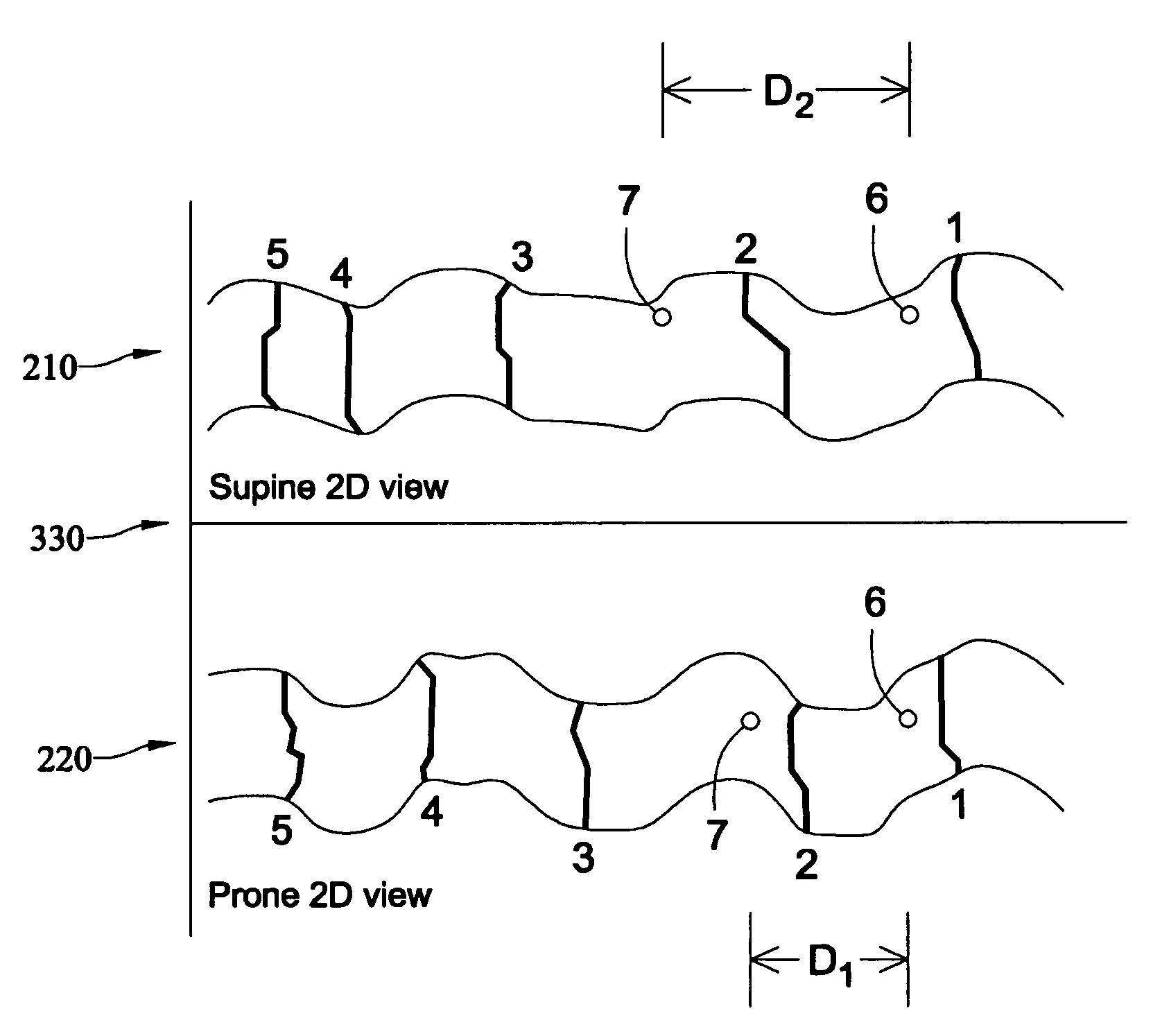 Method and apparatus for synchronizing corresponding landmarks among a plurality of images