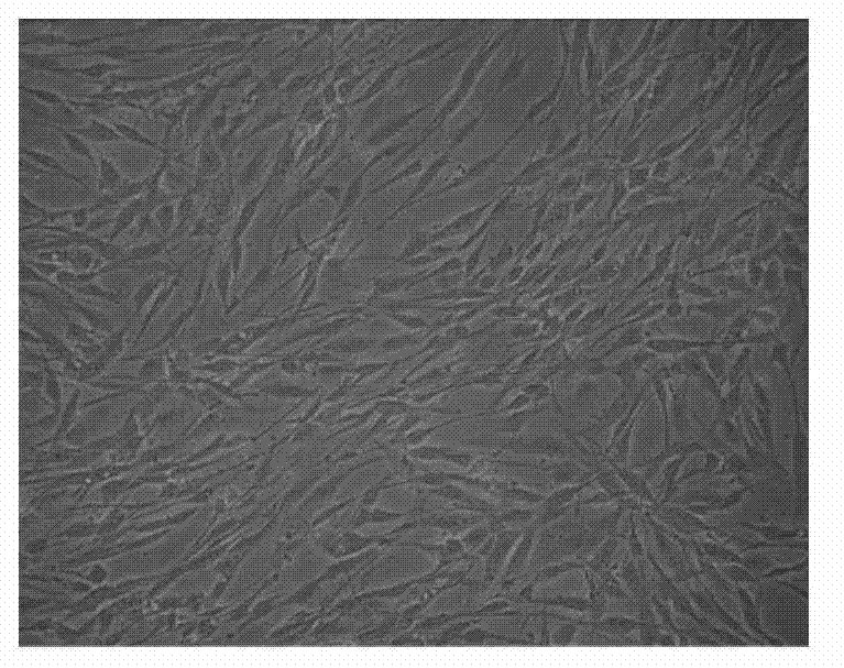 Pancreatic stem cell preparation method and special culture medium composition therefor