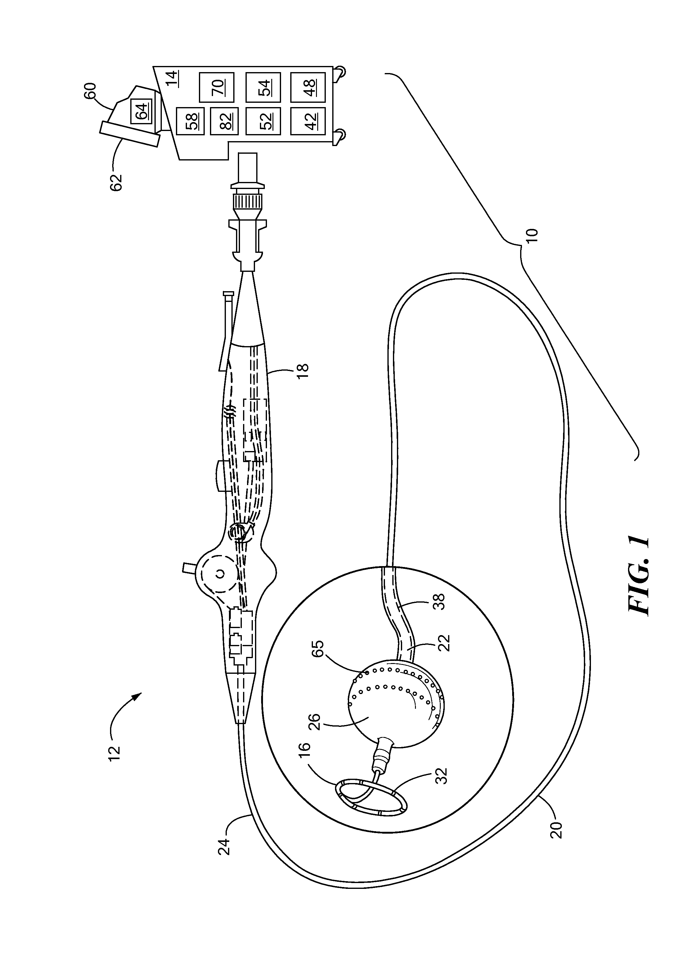 Compliant balloon with liquid injection