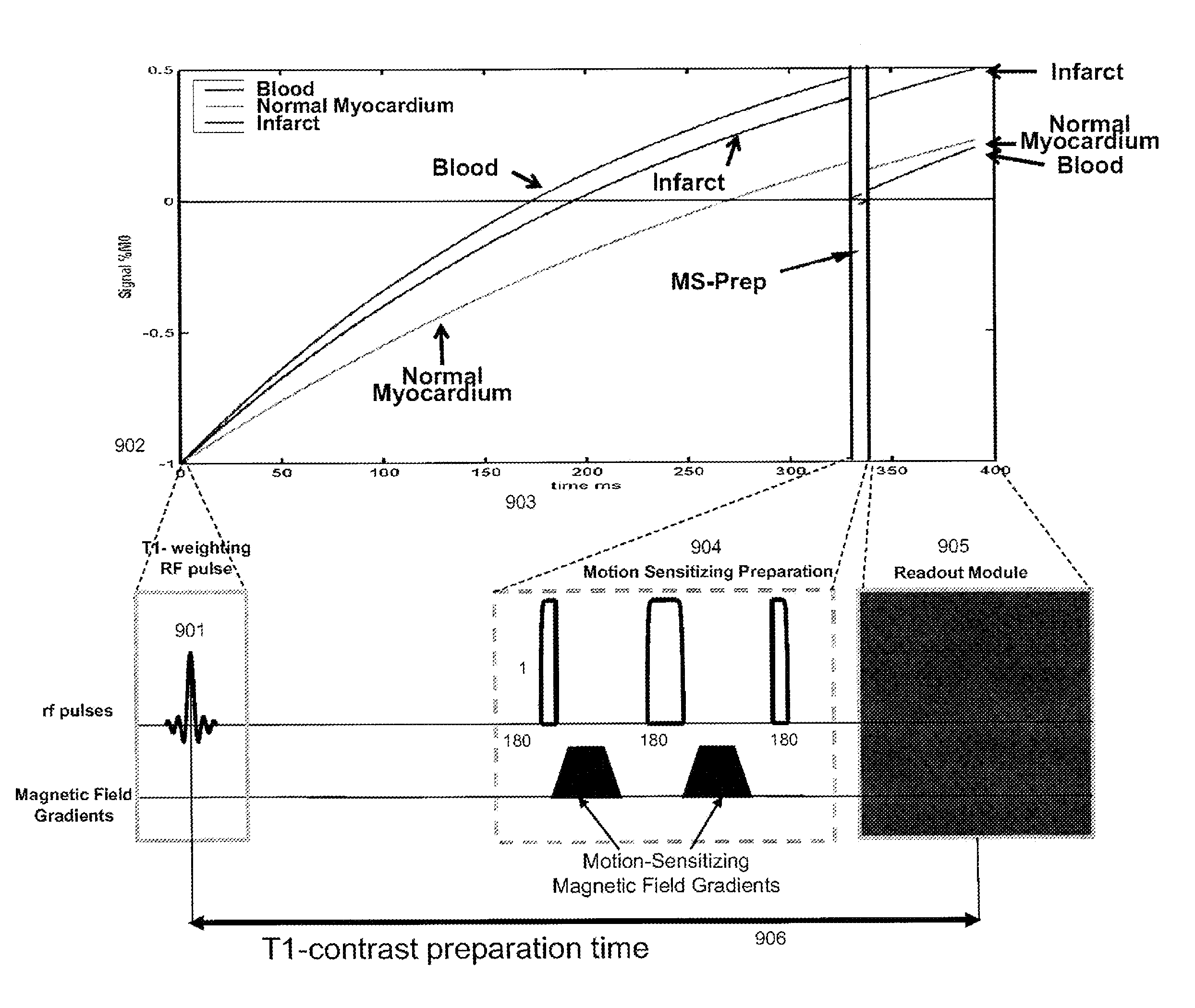 Motion-attenuated contrast-enhanced cardiac magnetic resonance imaging system and method