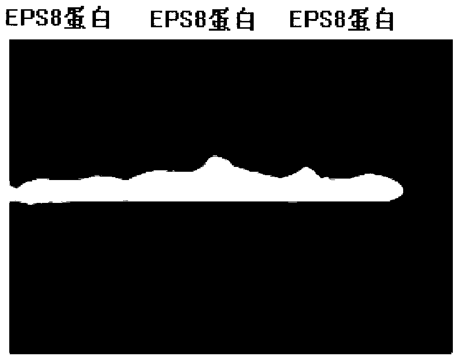 Tumor vaccine of recombinant murine EPS8 gene, and preparation method and application thereof