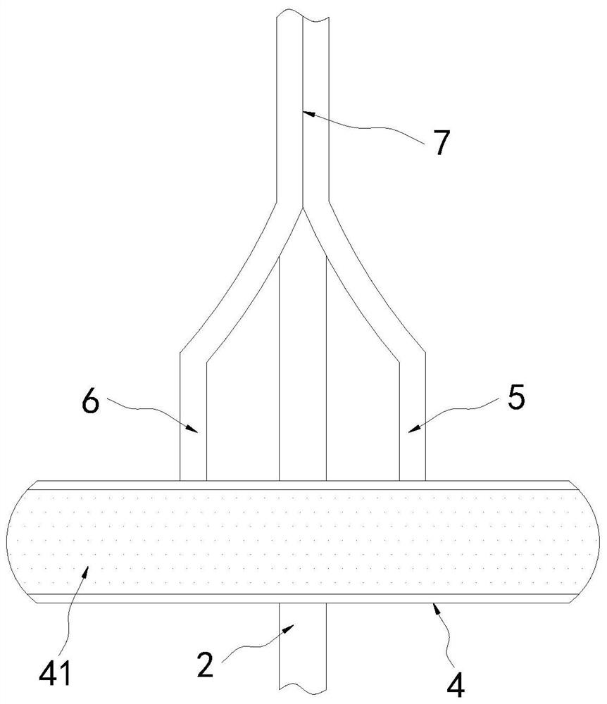 Air bubble discharging device for gynecological hysteroscopy