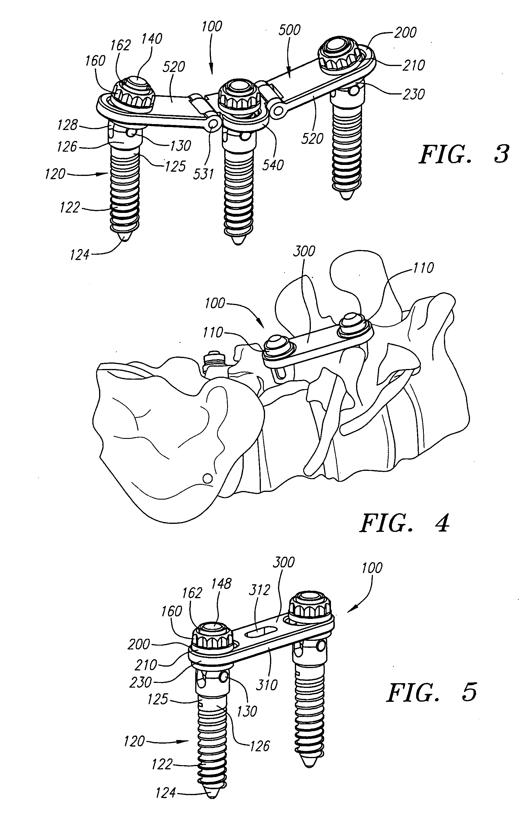 Selective axis anchor screw posterior lumbar plating system