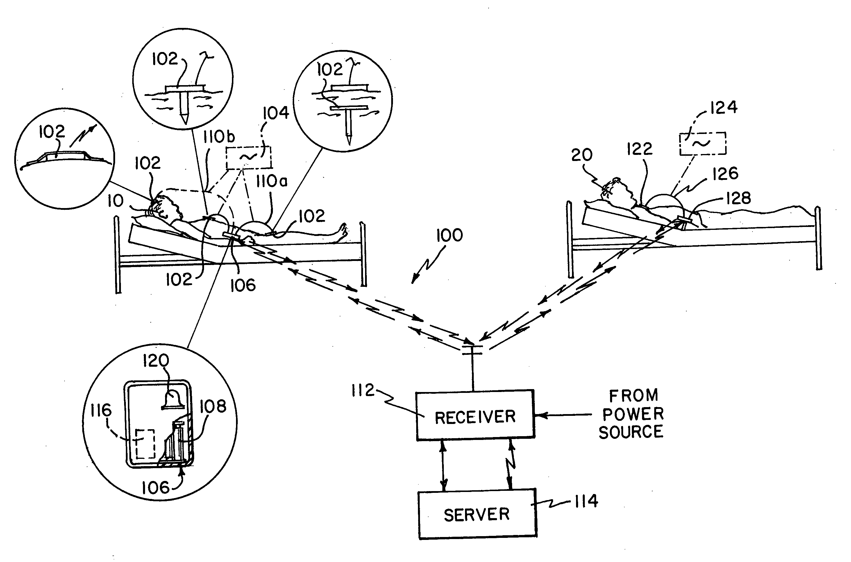 Wireless patient monitoring system