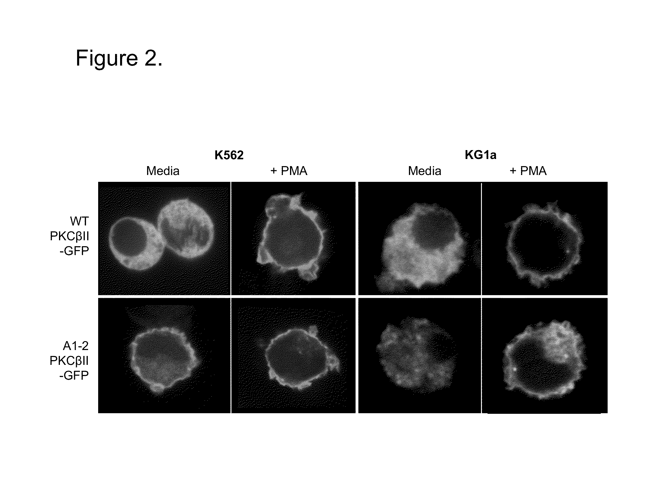 Prodrug anti-cancer therapy