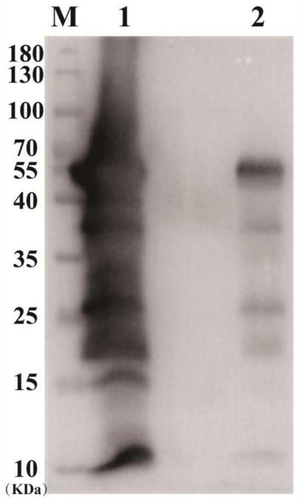 A kind of non-integrated listeria vaccine and anti-tumor immune response method