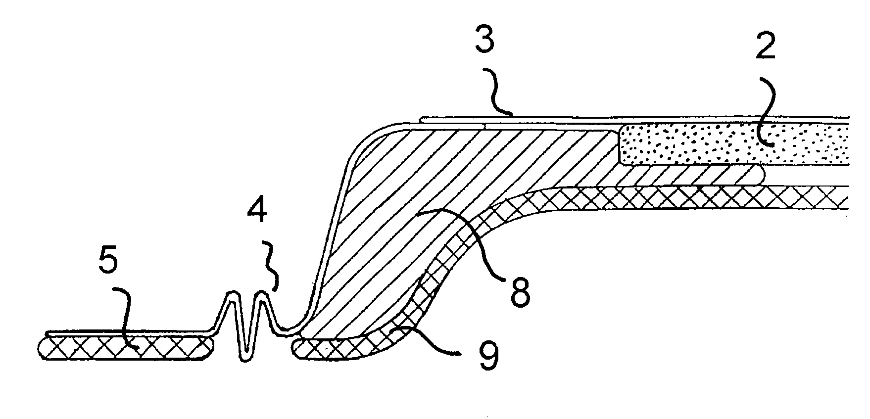 Ostomy appliance