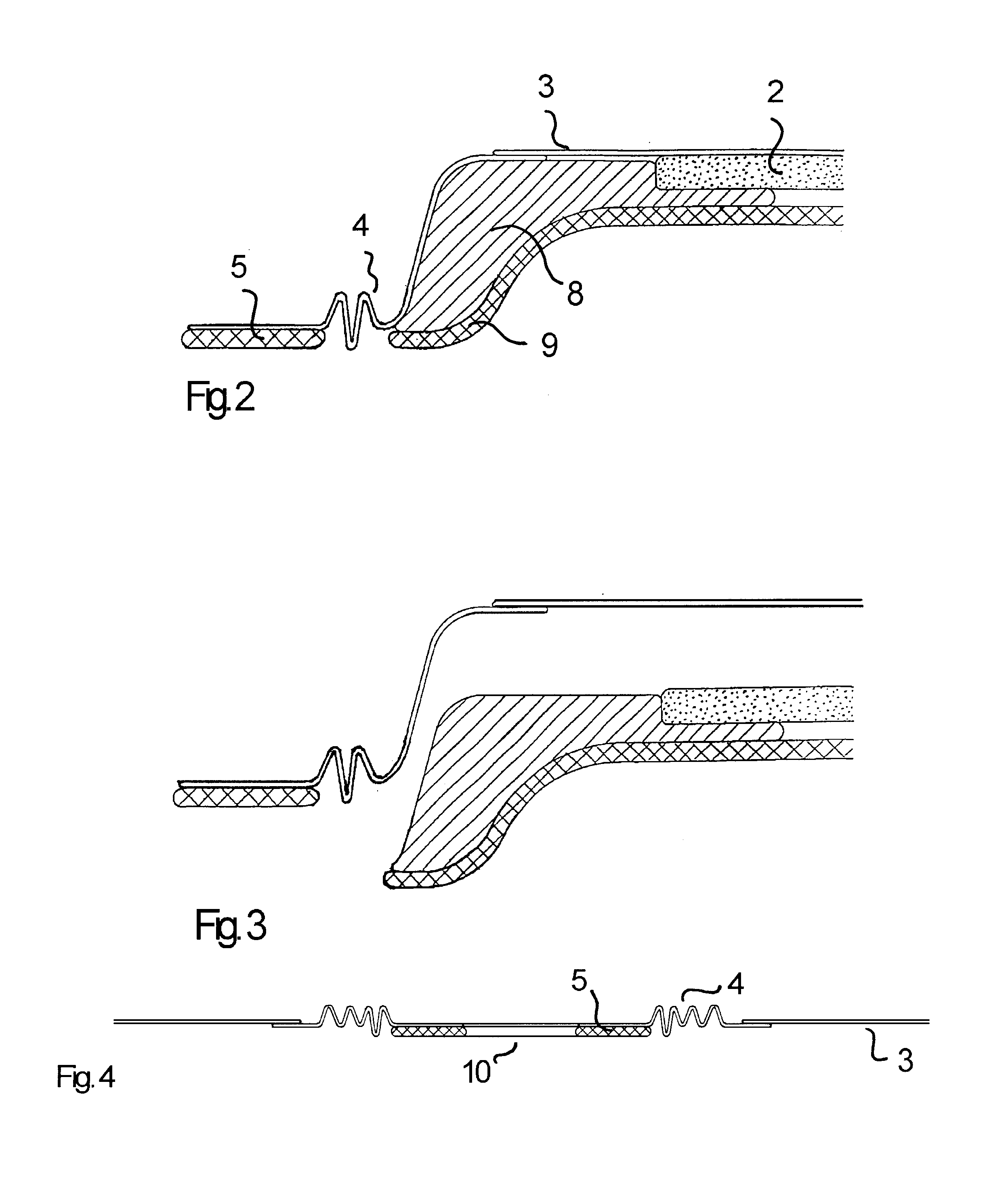 Ostomy appliance