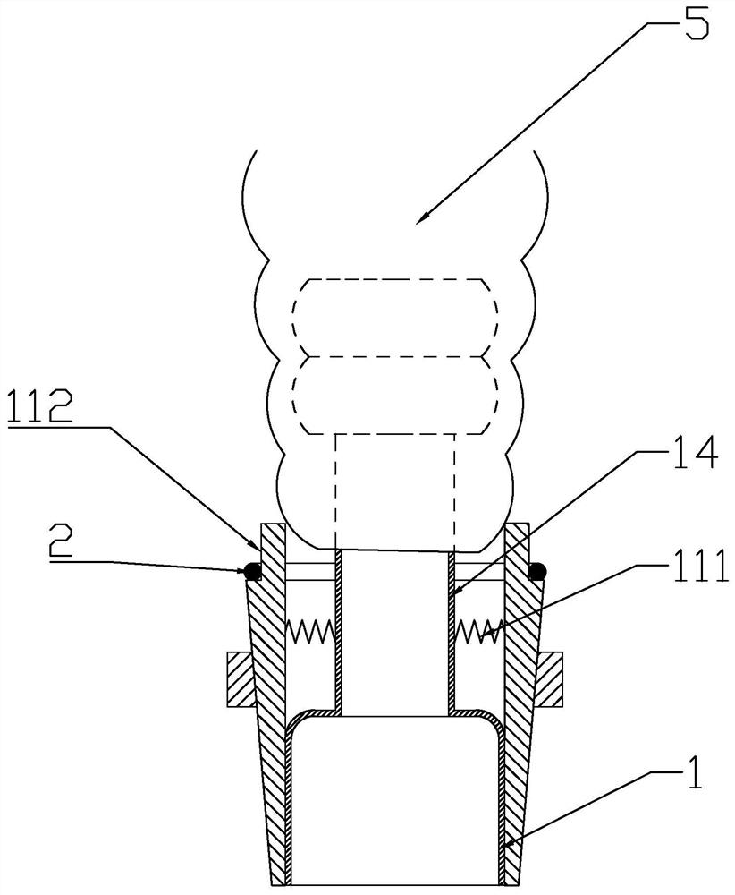 Intestinal wall fixing device of enteroscope during surgery