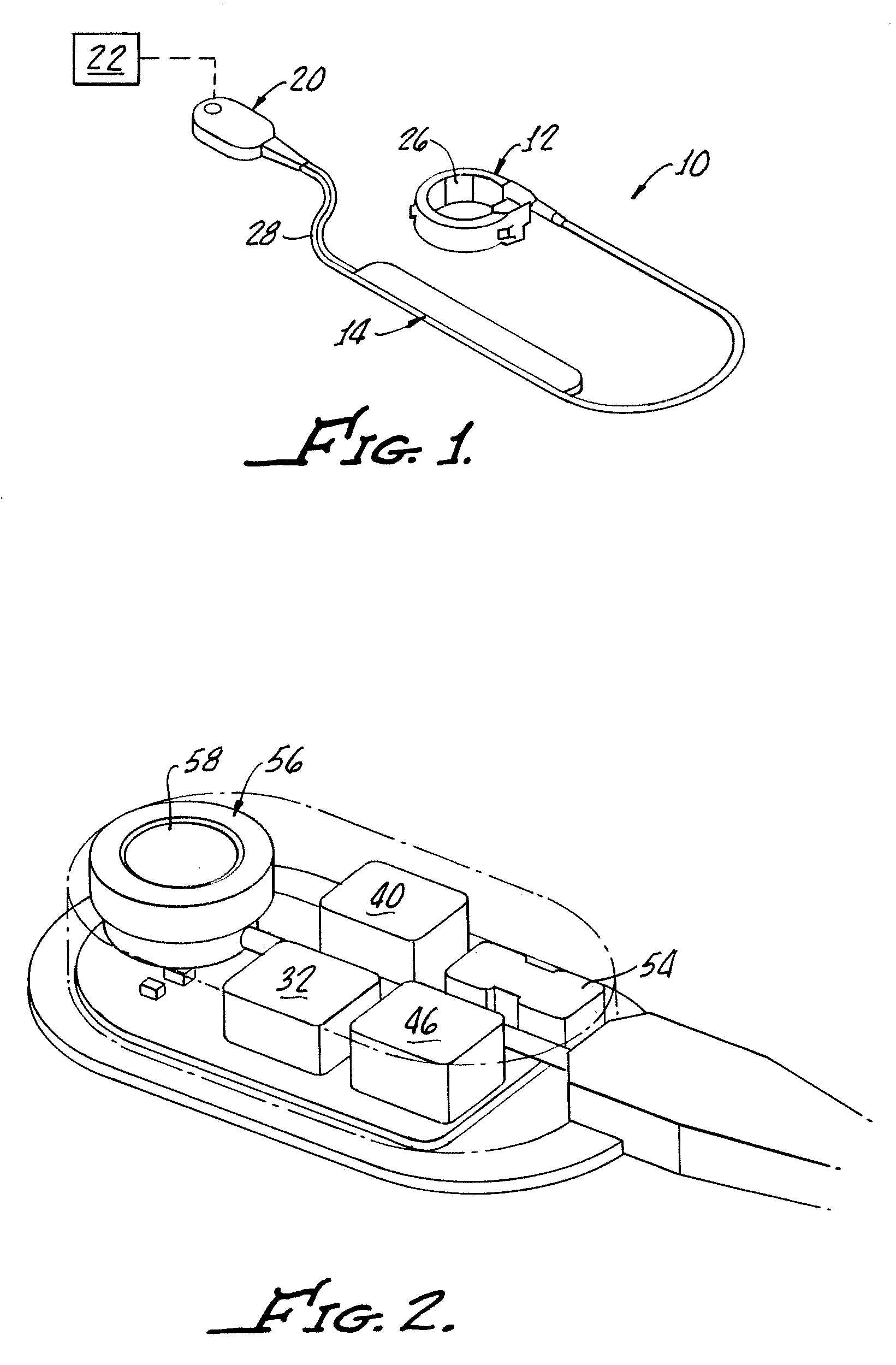 Implantable pump system