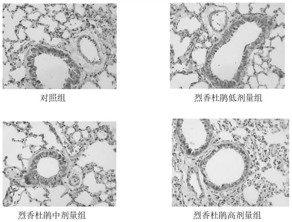 Atomizing agent for treating chronic obstructive pulmonary disease and preparation and application thereof