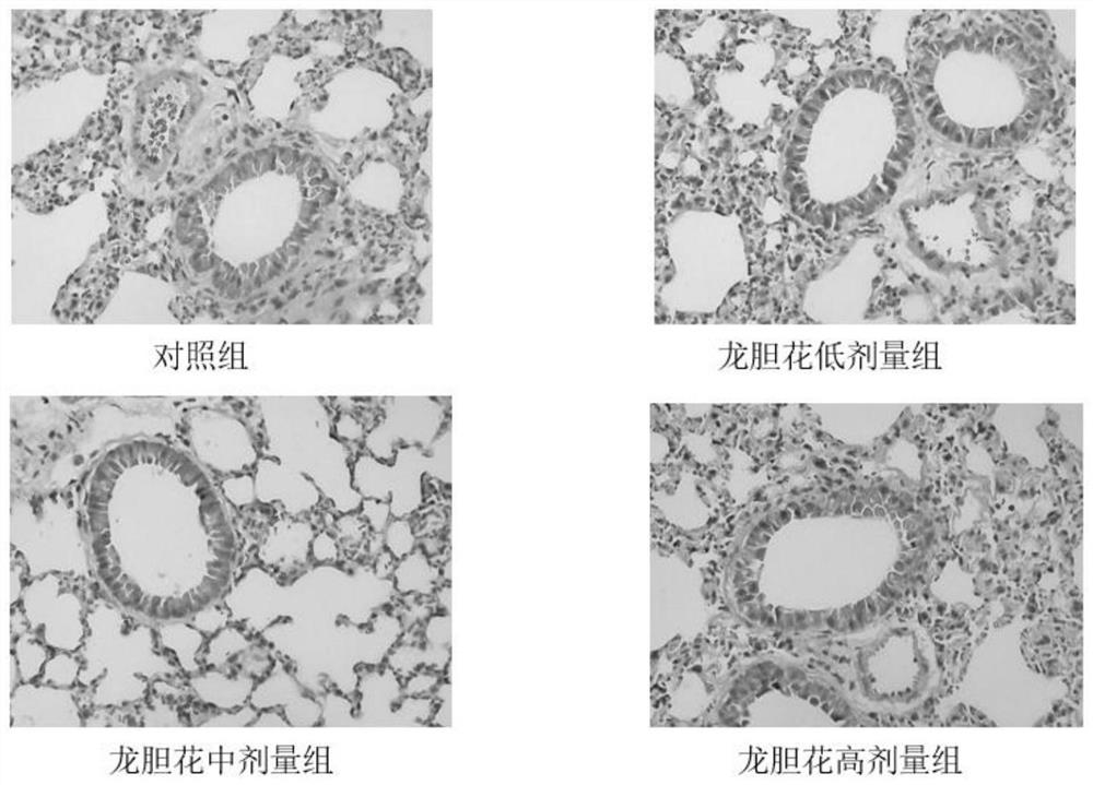 Atomizing agent for treating chronic obstructive pulmonary disease and preparation and application thereof