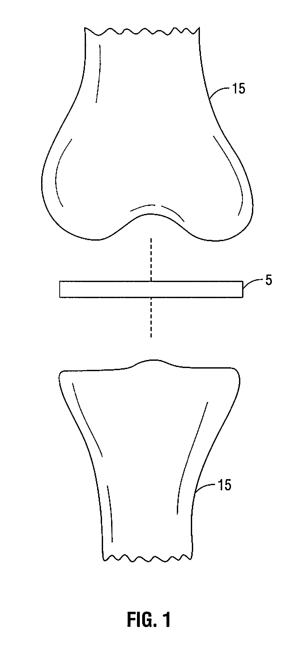 Method and apparatus for meniscal repair