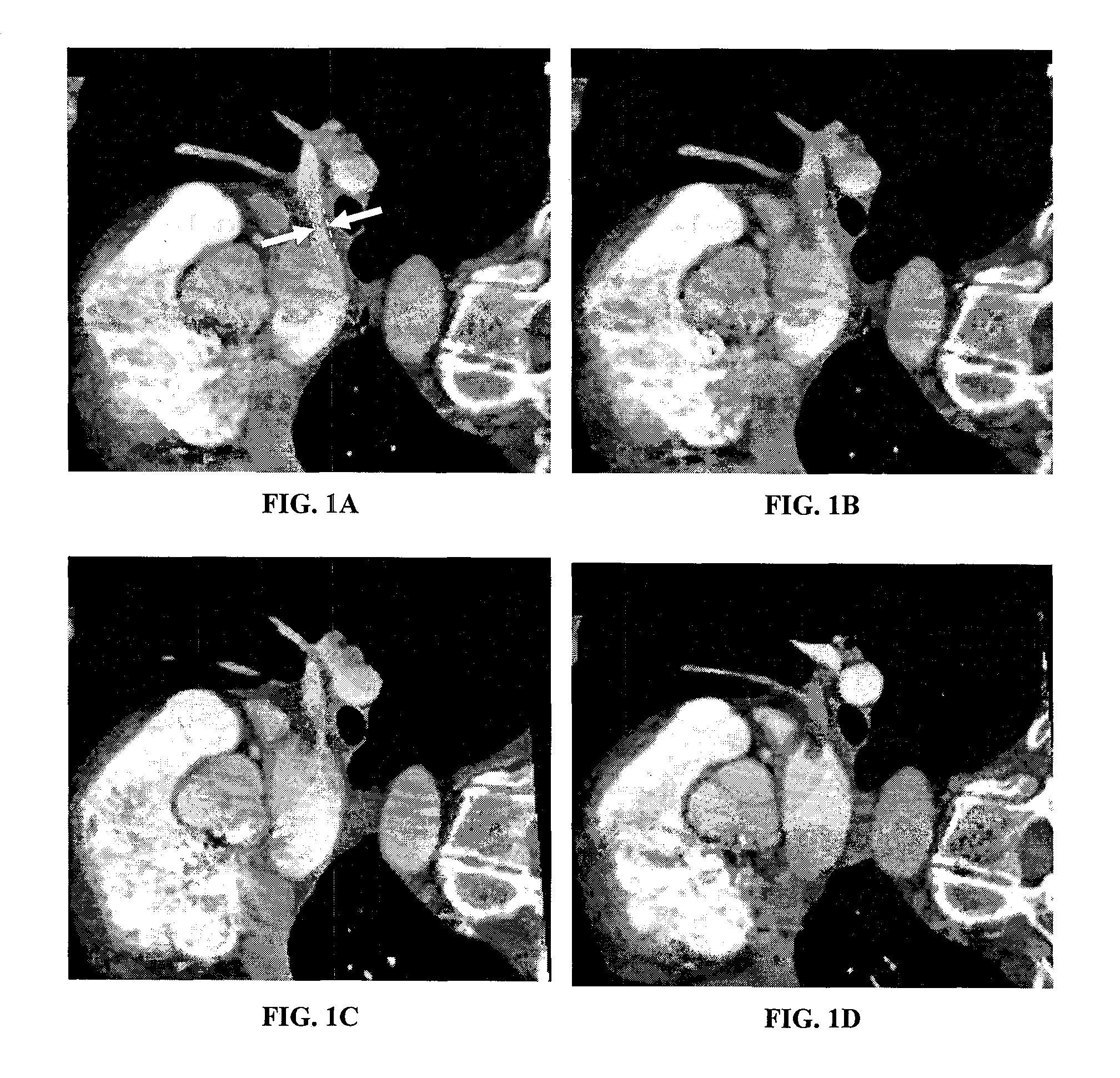 Automatic positioning of matching multi-planar image reformatting (MPR) views of multiple 3D medical images