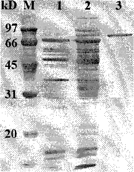 Anti-protease acidic alpha-galactosidase Aga-F75 and gene and application thereof