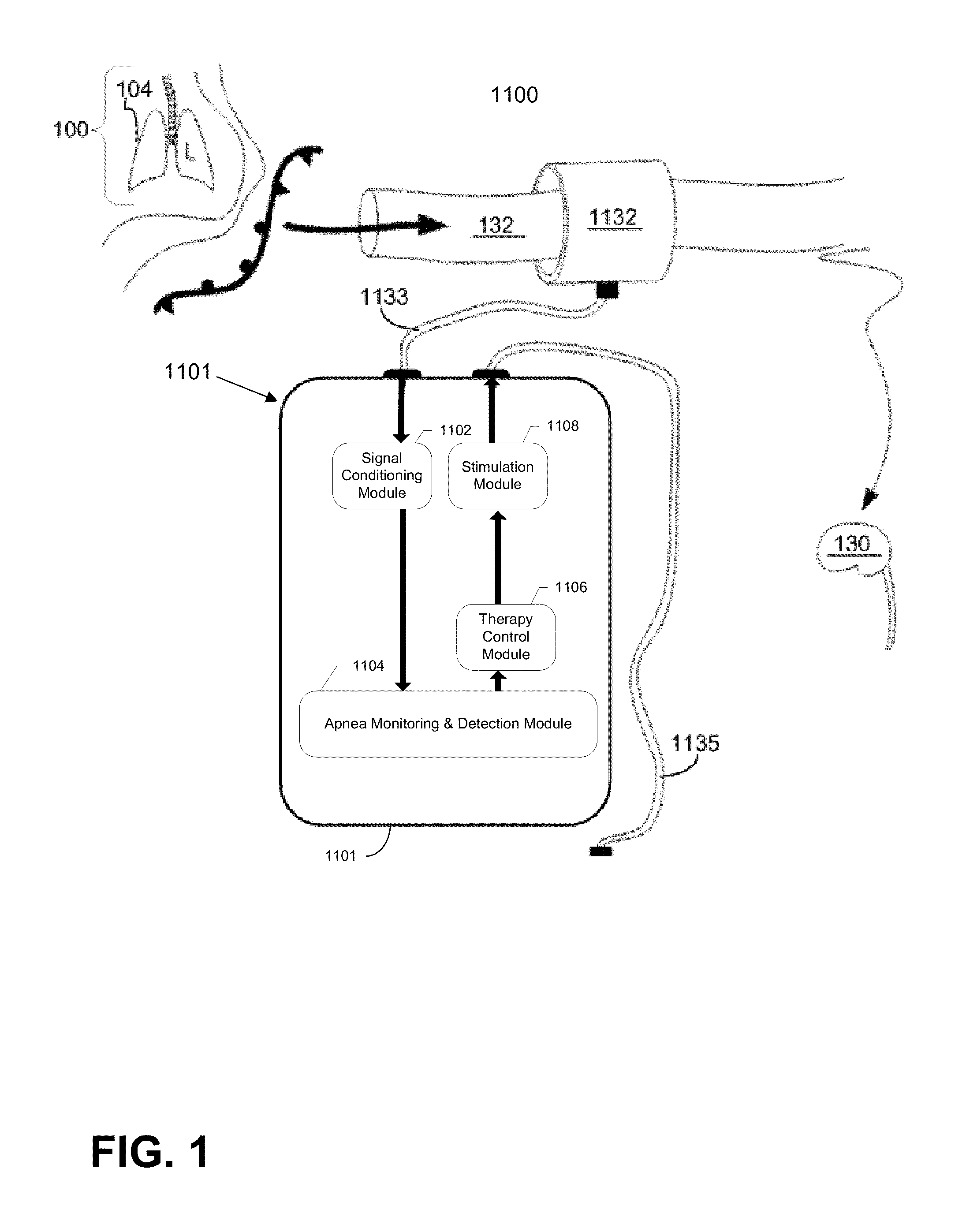 Neuromodulation system and method for treating apnea