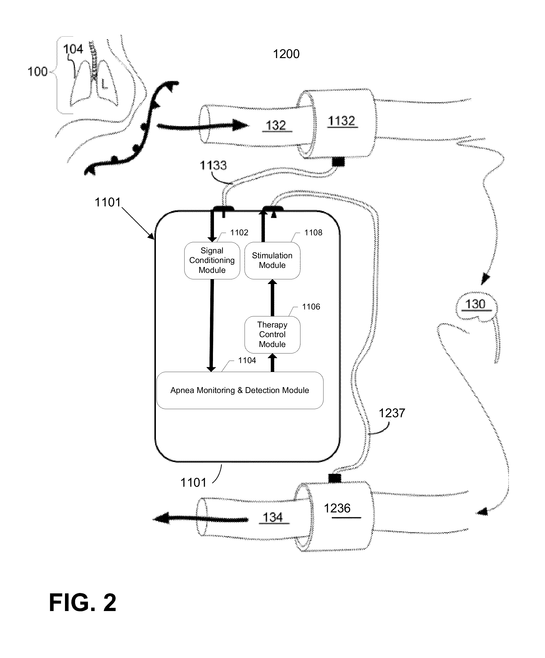 Neuromodulation system and method for treating apnea