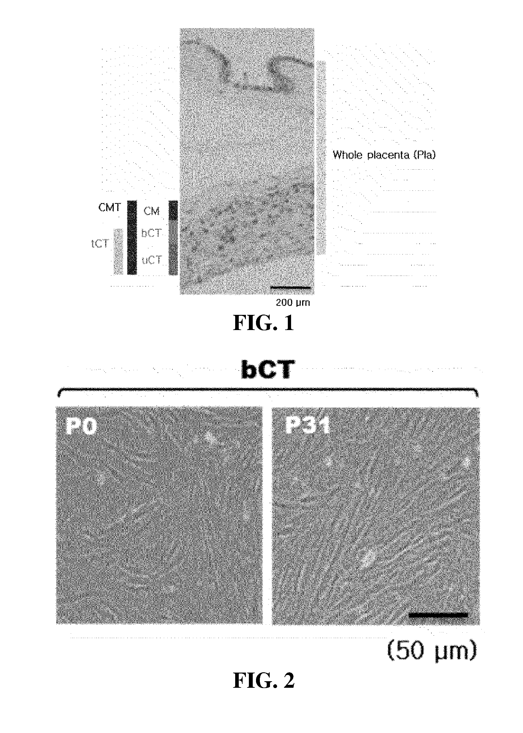 Stem Cells Derived from Basal Portion of Chorionic Trophoblast Layer and Cell Therapy Comprising Same