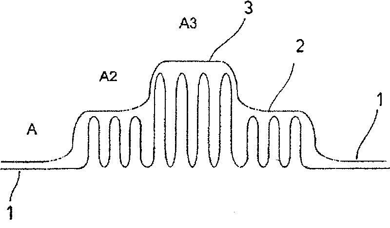 Surgical implant