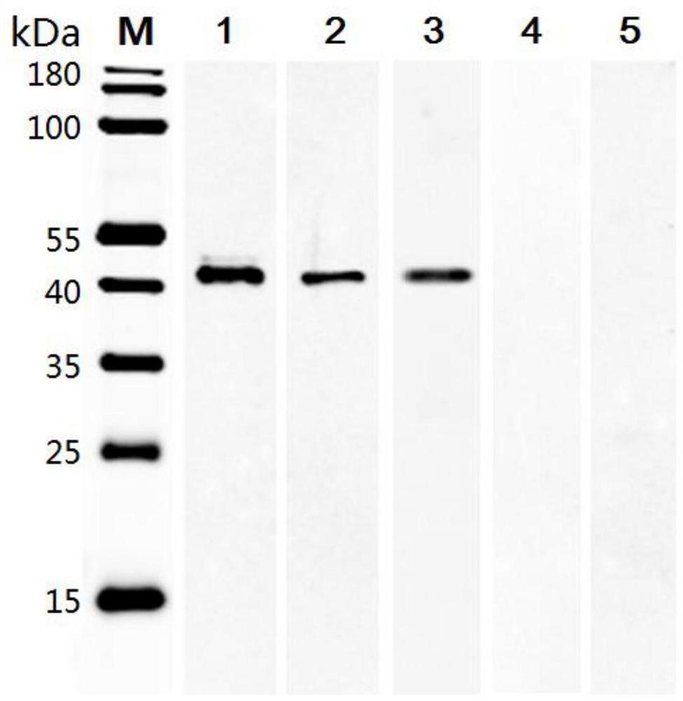 A recombinant fusion protein smsap of Schistosoma mansoni and its application in immunodiagnosis of schistosomiasis