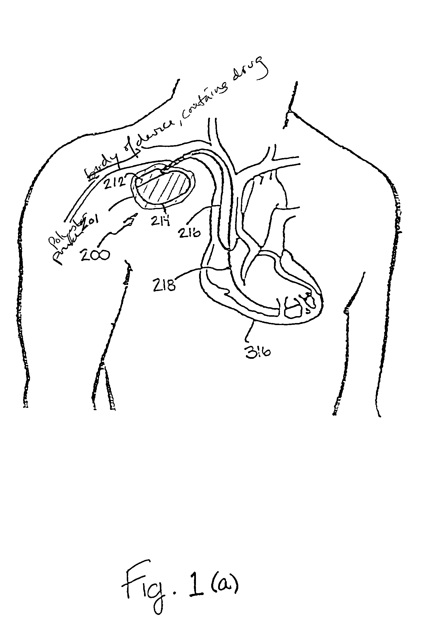 Implantable medical device with enhanced biocompatibility and biostability