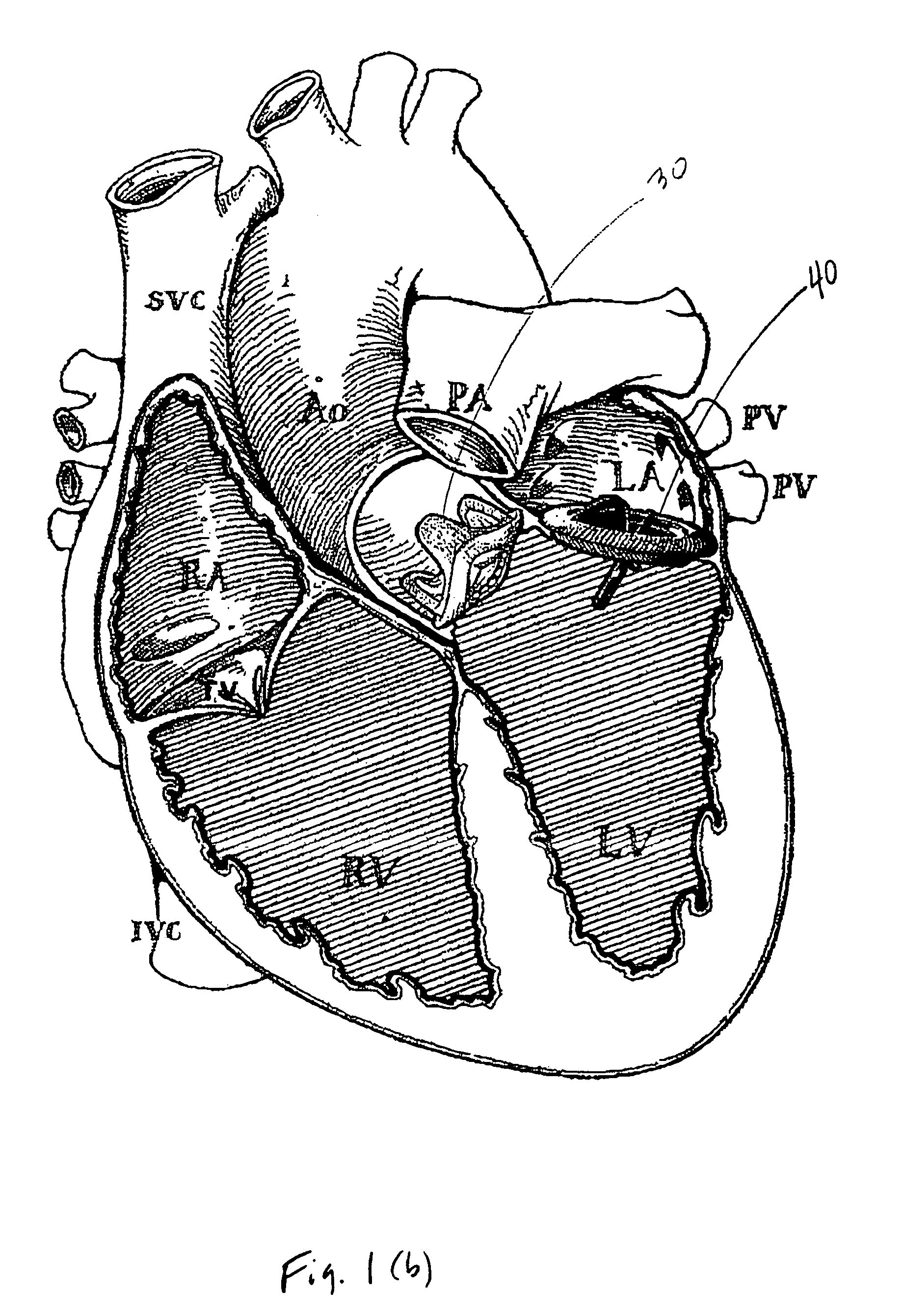 Implantable medical device with enhanced biocompatibility and biostability