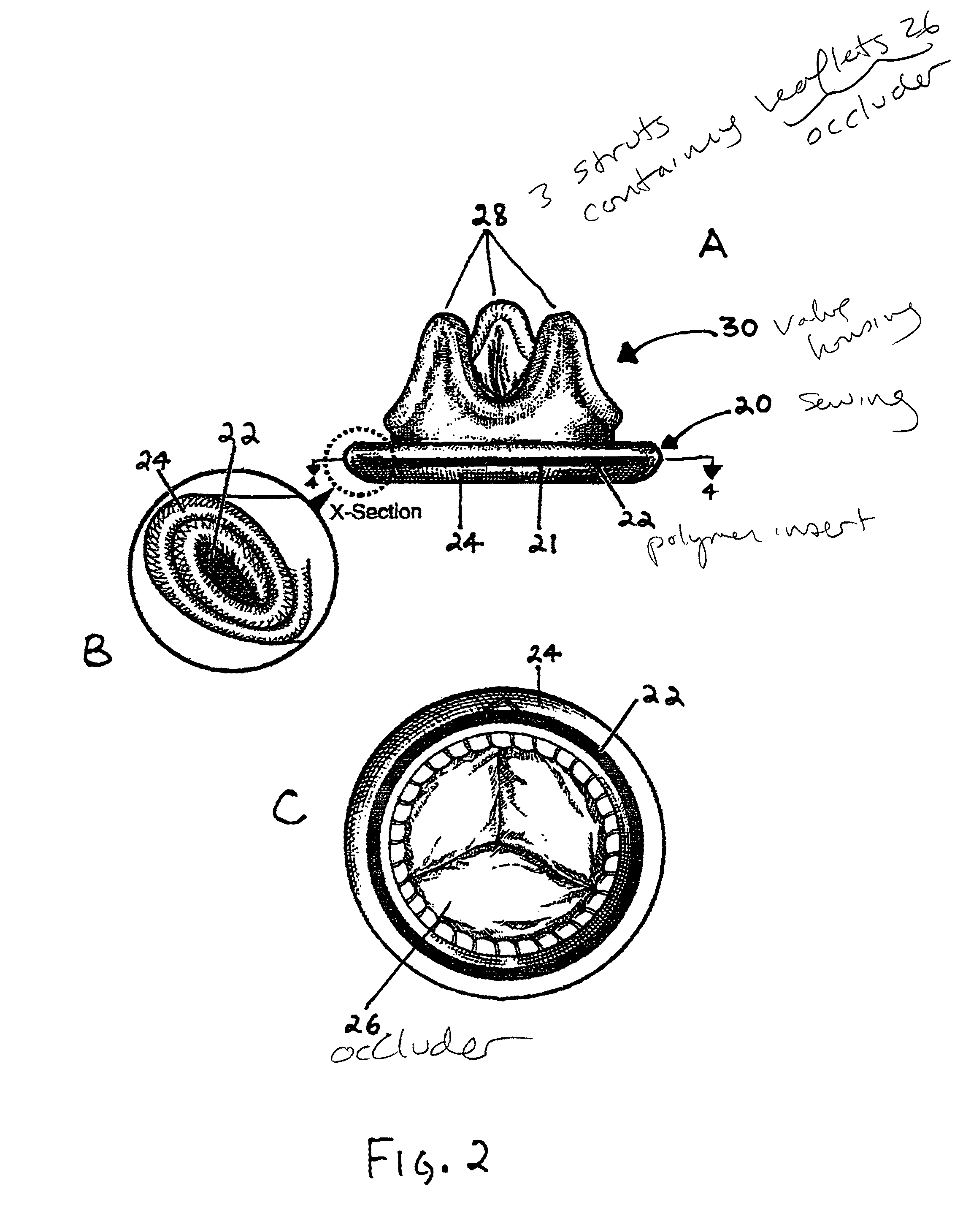 Implantable medical device with enhanced biocompatibility and biostability