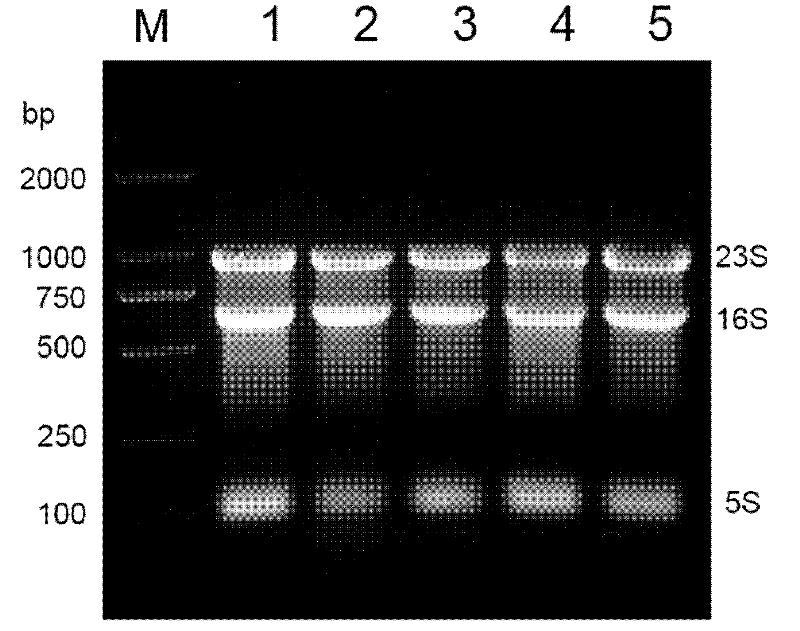 Total RNA preparation without genomic DNA