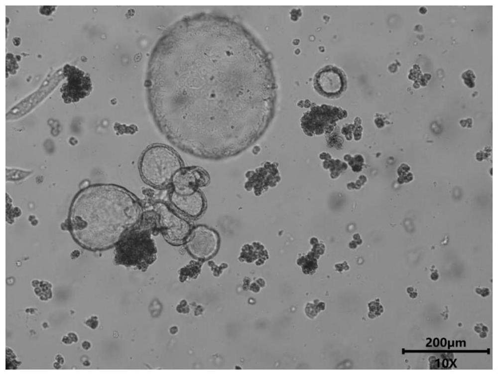 A method for evaluating drug hepatotoxicity based on liver organoid model