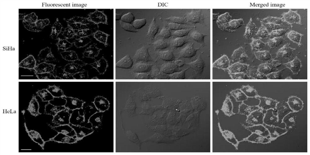 Double-targeting fluorescent probe capable of simultaneously visualizing plasma membrane and lysosome and application of double-targeting fluorescent probe