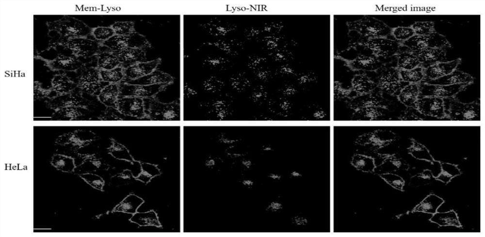 Double-targeting fluorescent probe capable of simultaneously visualizing plasma membrane and lysosome and application of double-targeting fluorescent probe