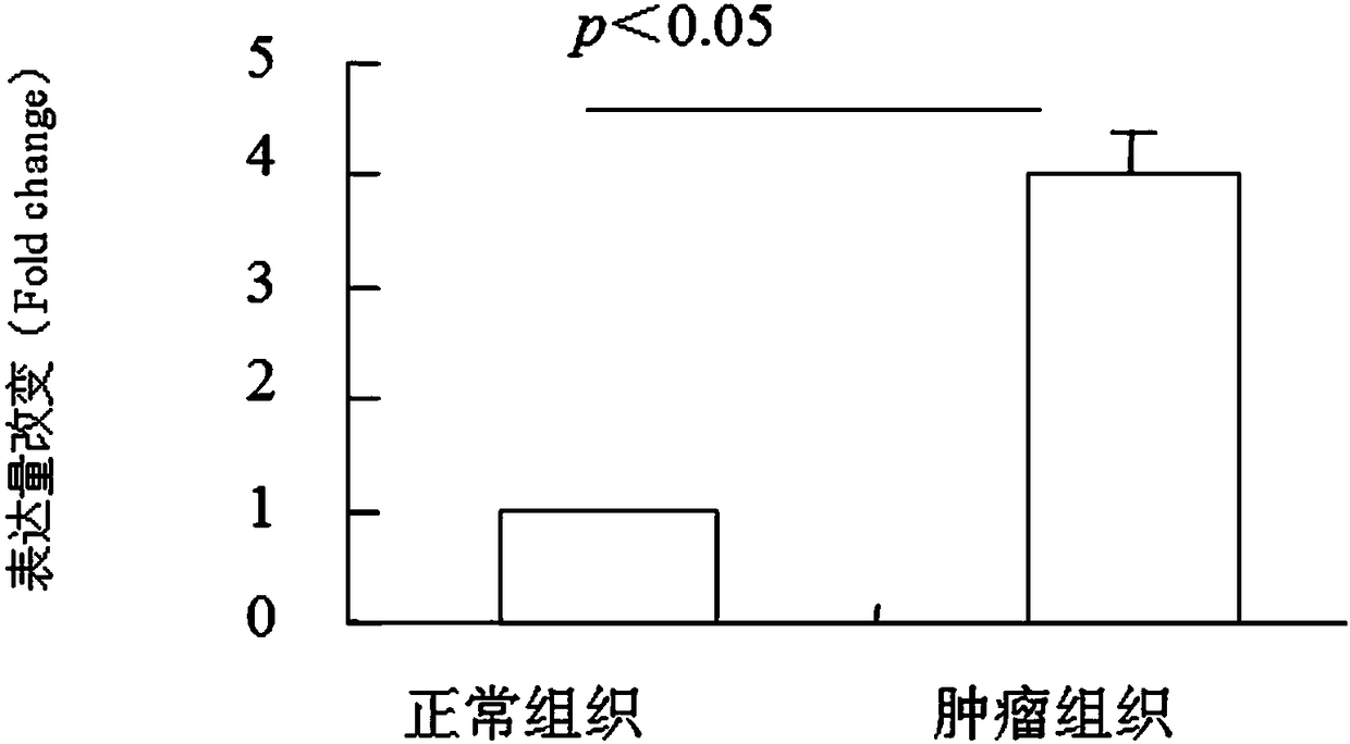 Application of kidney cancer prognosis novel molecular marker non-coding RNA LINC00158, kit and detection method