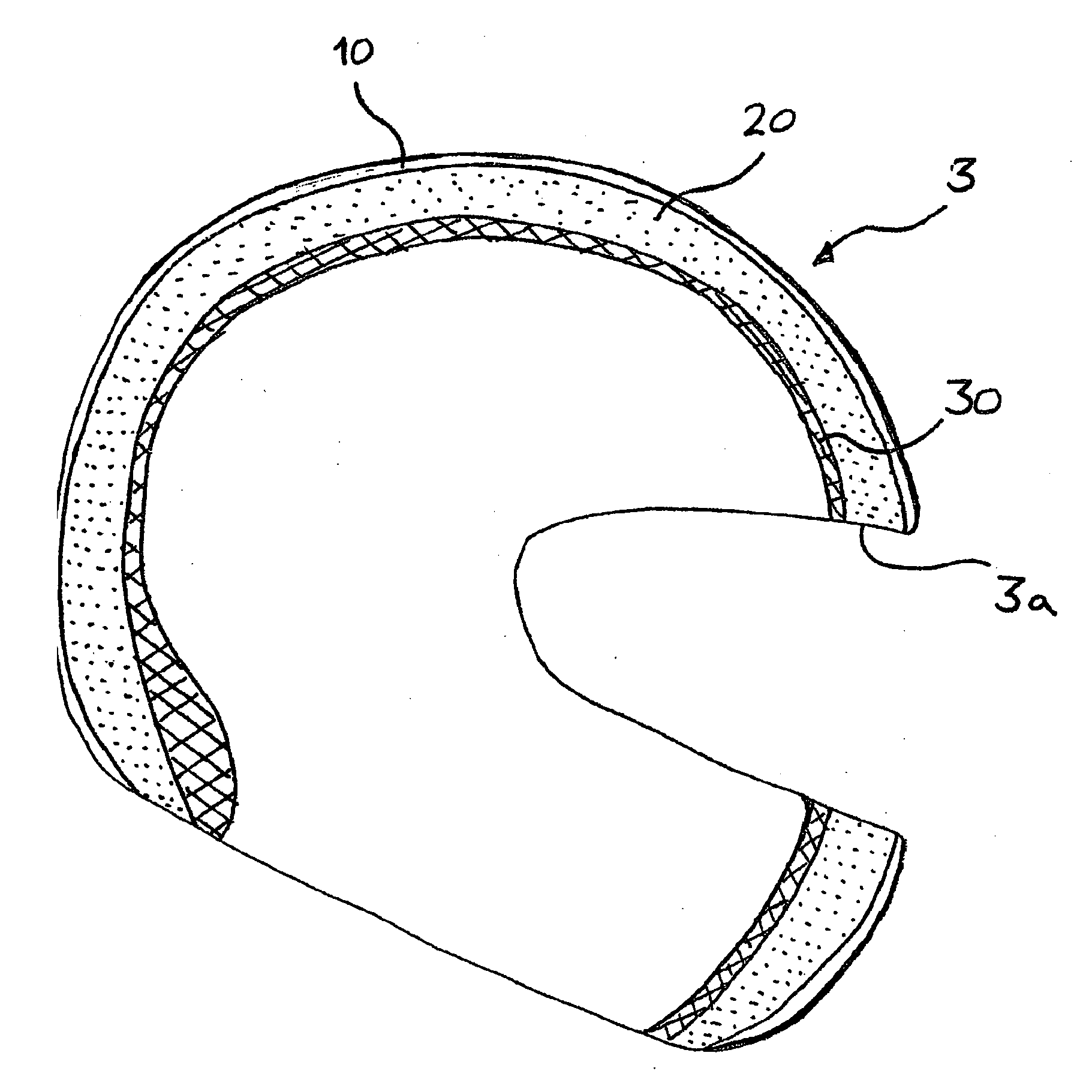 Brain cooling device