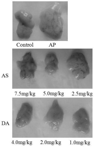 Artesunate succinylated derivative and preparation method and application thereof in medicines