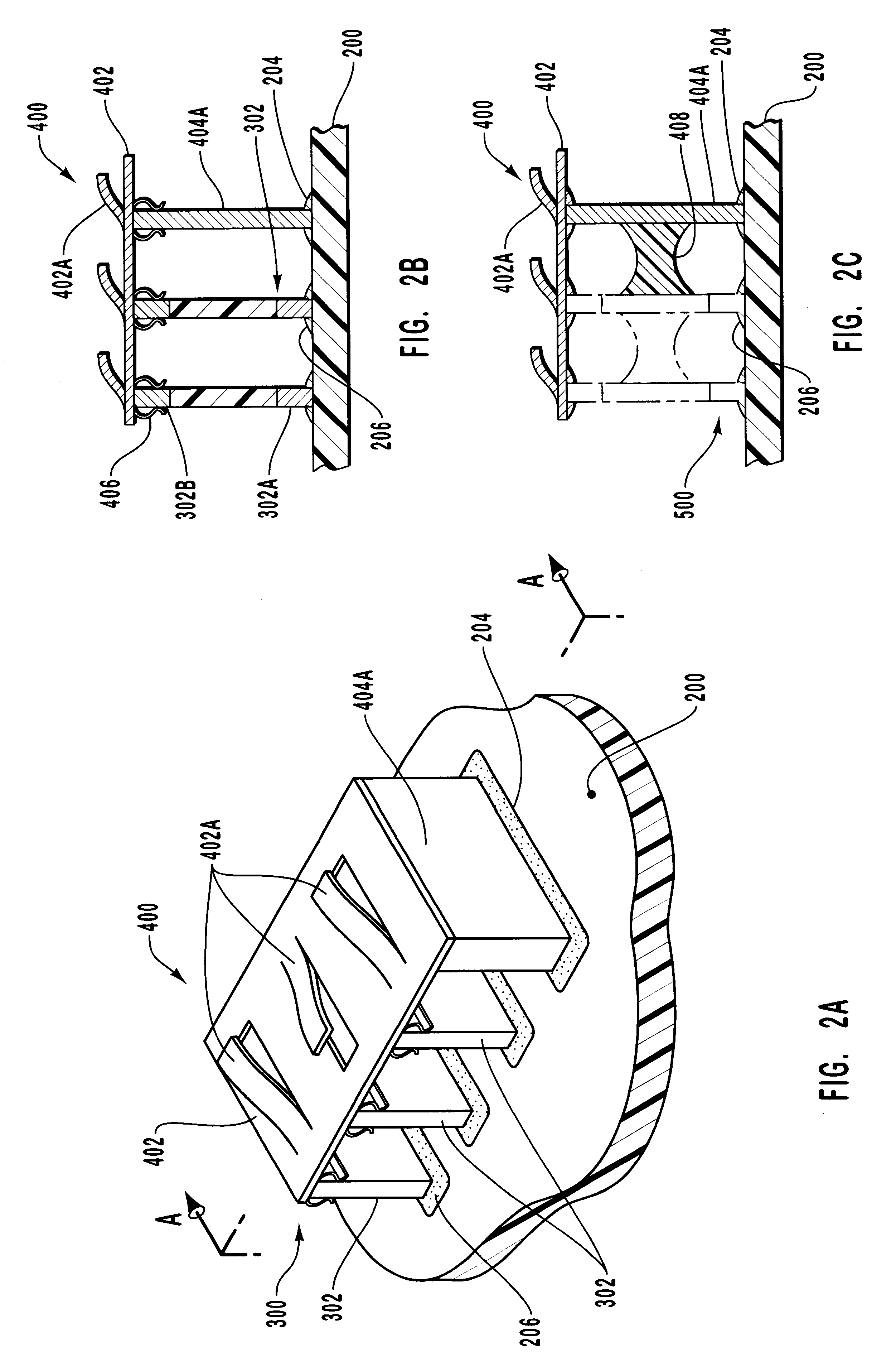 Chip component assembly