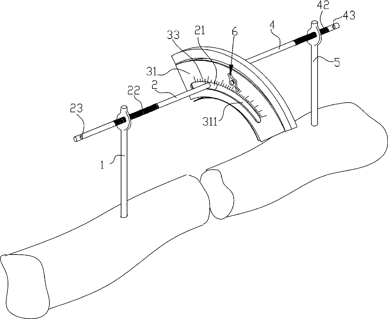 Intraoperative percutaneous fracture end temporary fixation and reduction device and operation method thereof