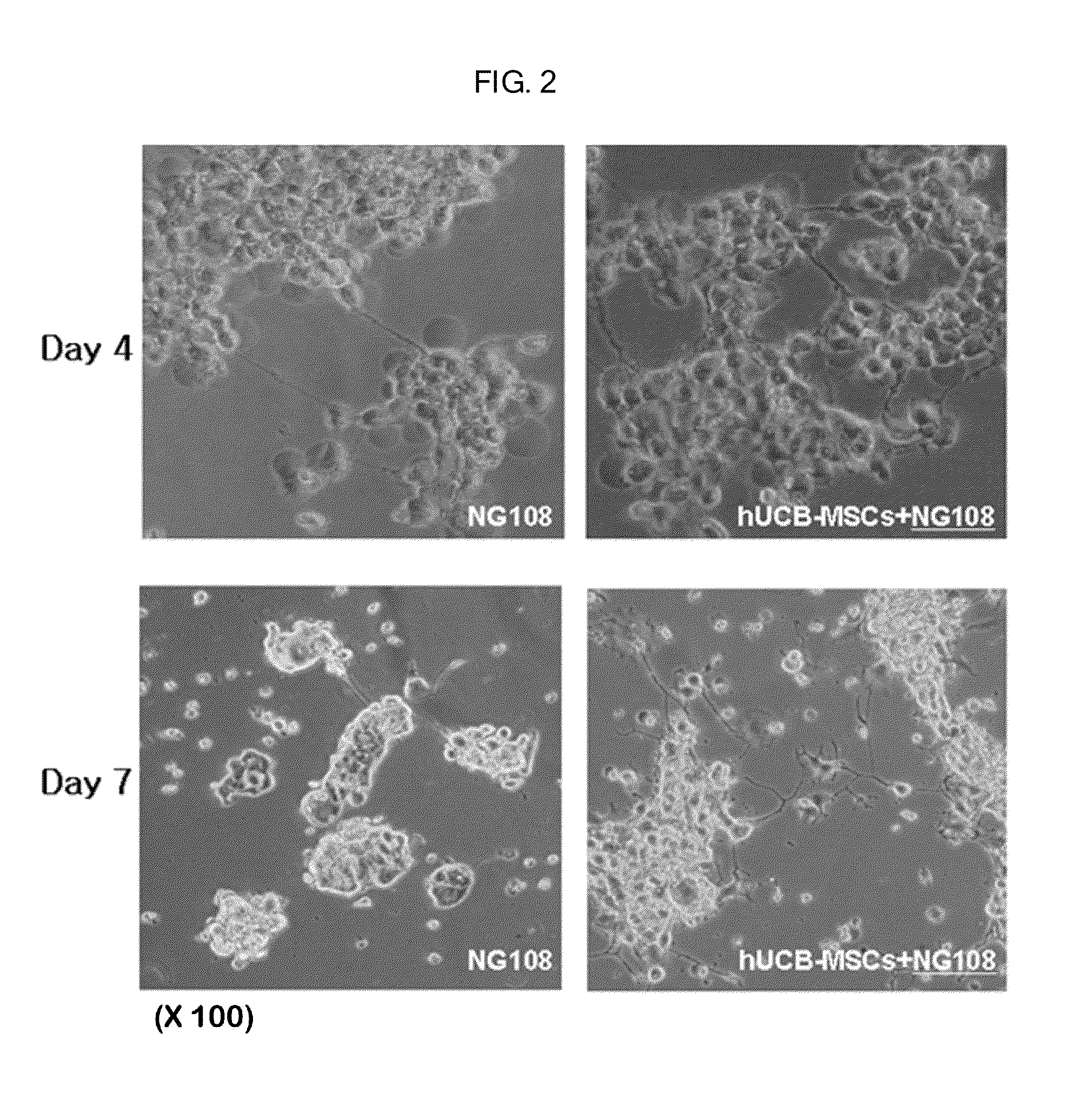 Composition containing human umbilical cord blood-derived mesenchymal stem cell for inducing differentiation and proliferation of neural precursor cells or neural stem cells to neural cells