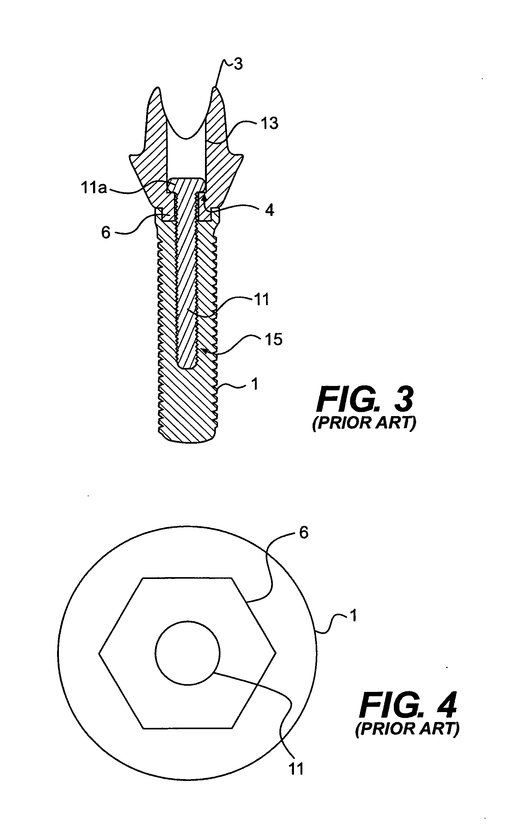 Dental abutment including fillet