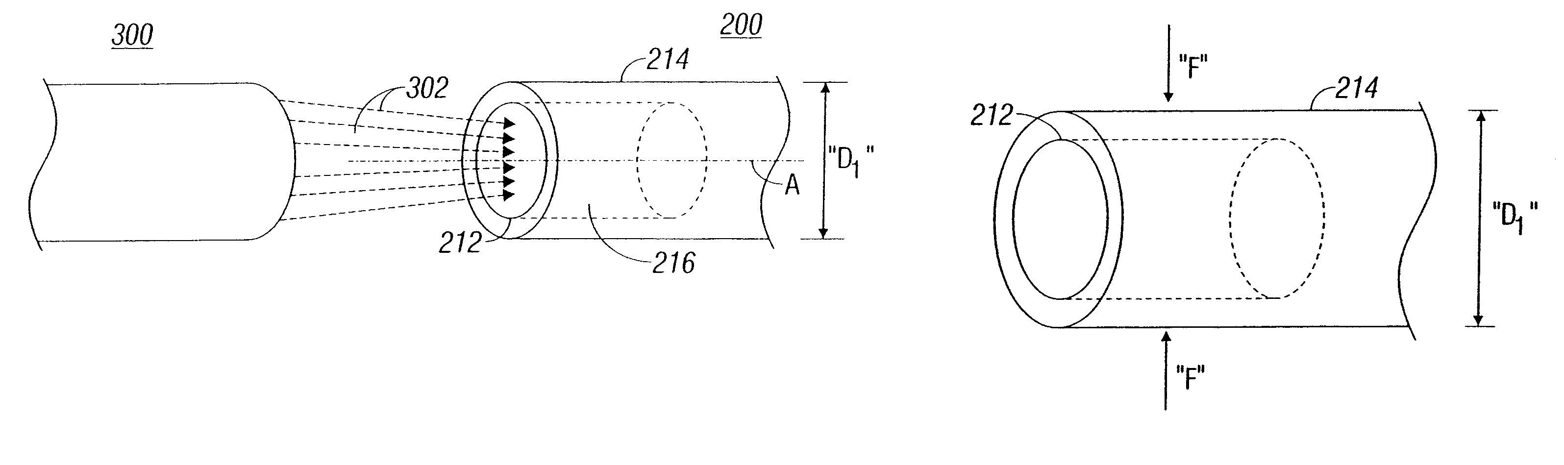 Methods of altering surgical fiber