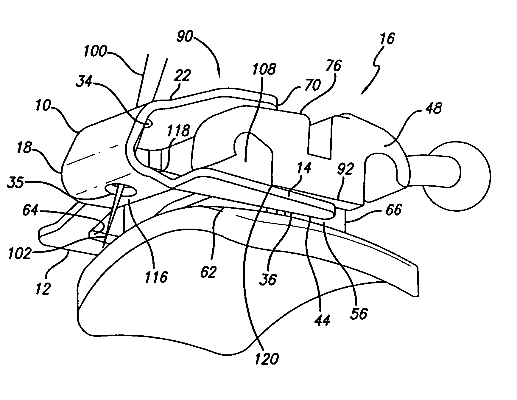 Low profile self-ligating bracket assembly and method of use