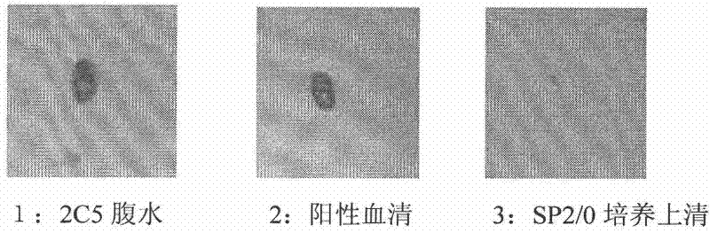 Anti-rabies virus monoclonal antibody and application