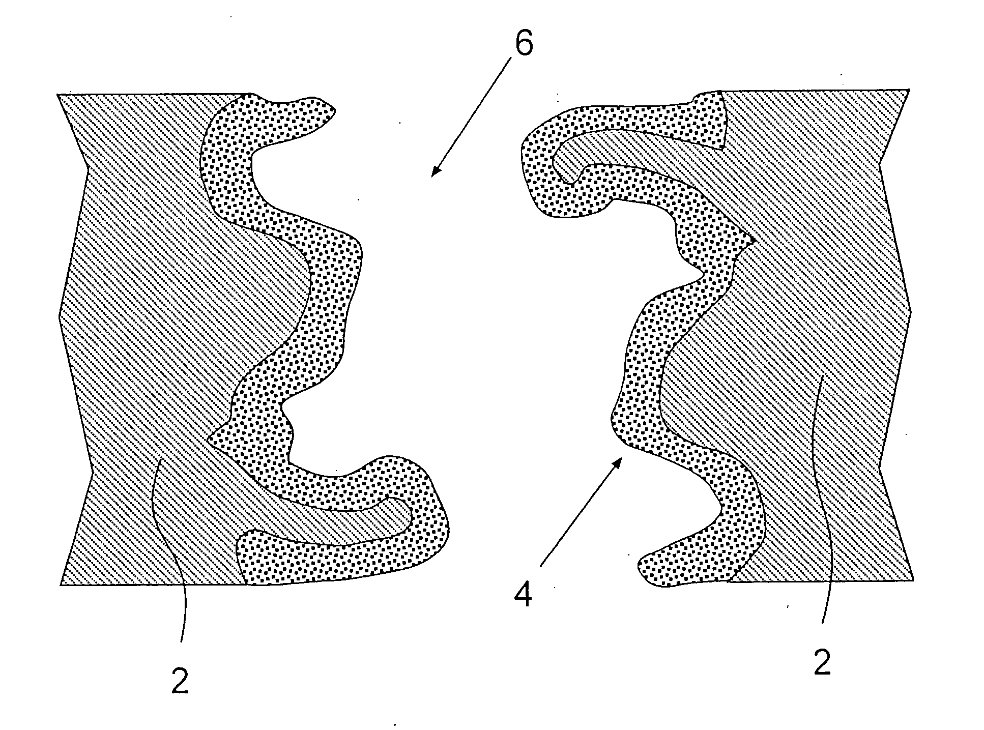 Porous adsorptive or chromatographic media